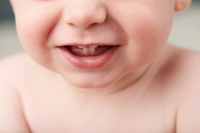 Pertumbuhan Gigi Bayi Hingga Balita: Tahapan dan Ciri-Ciri - DokterSehat