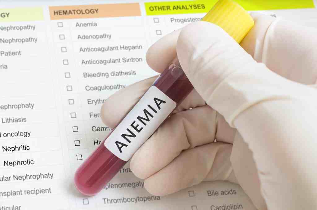 Anemia Sideroblastik: Gejala, Penyebab, Pengobatan, dll