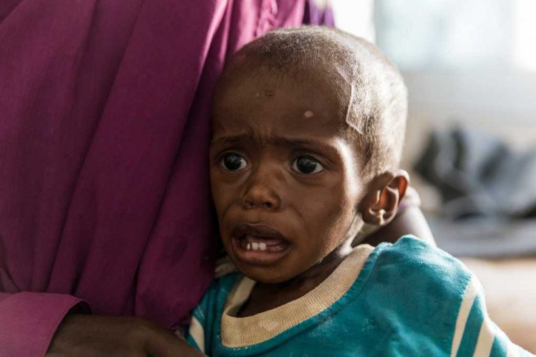 9 Masalah Gizi pada Anak (Ketahui & Waspadai) DokterSehat