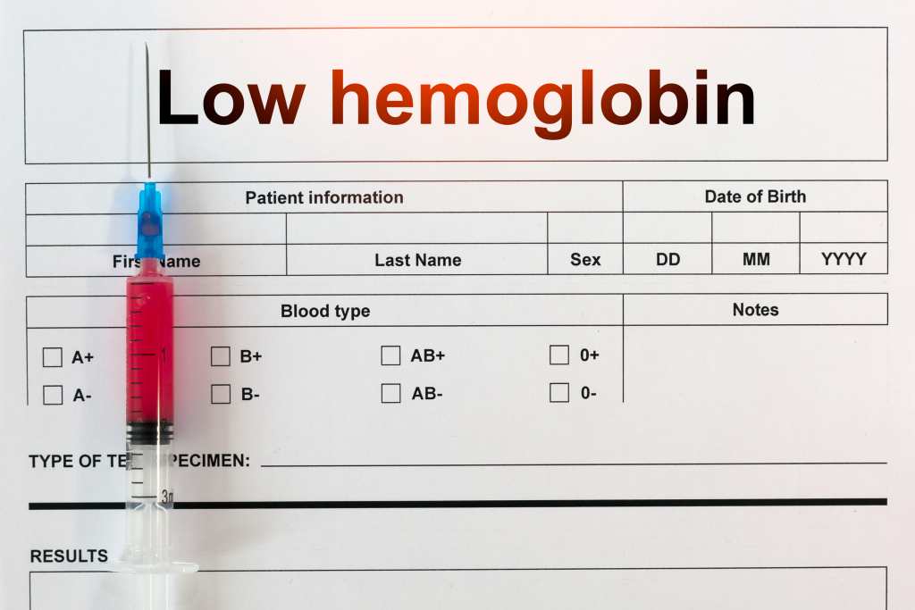 Hemoglobin rendah artinya