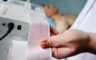 Elektrokardiogram (EKG): Indikasi, Tata Laksana, Biaya, dll