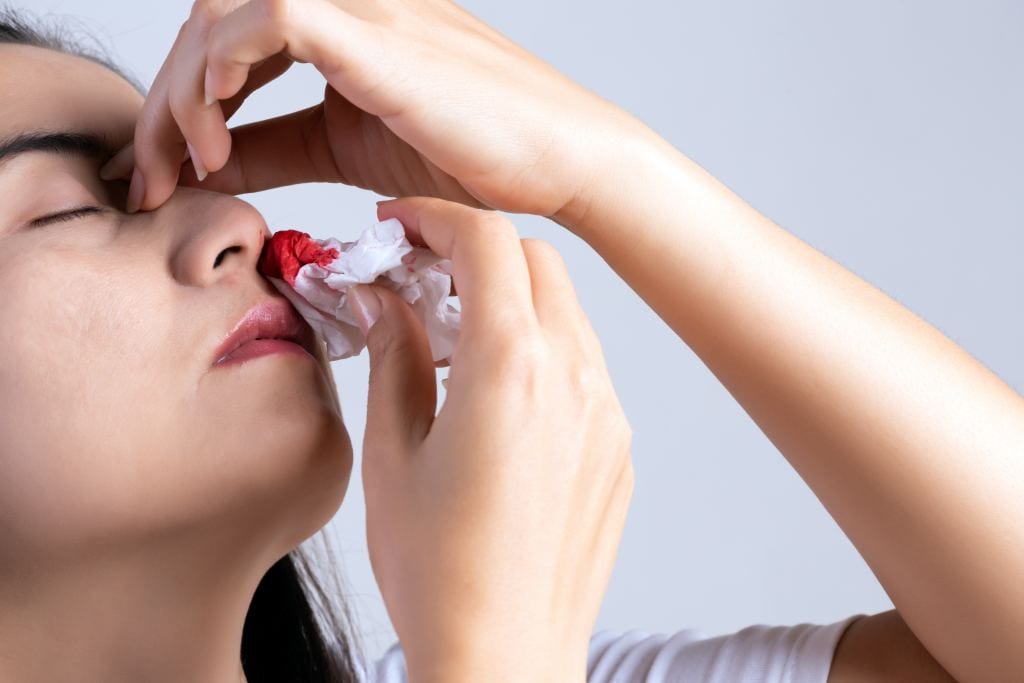 Mimisan Epistaxis Gejala Penyebab Cara Mengatasi Dll Doktersehat 9390