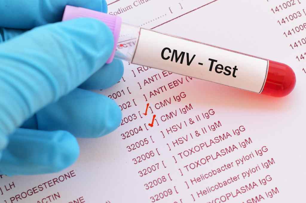 Cytomegalovirus (CMV): Gejala, Penyebab, Pengobatan, dll