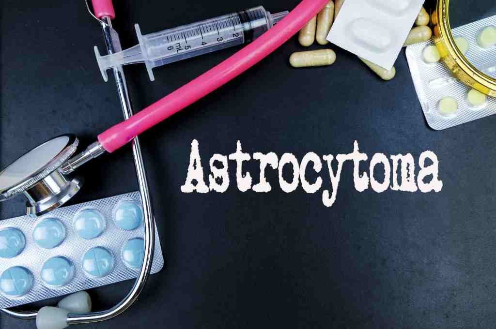 Astrositoma: Gejala, Penyebab, Pengobatan, dll