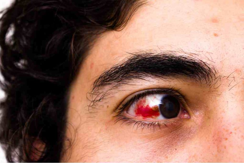 retinopati-diabetik-gejala-penyebab-diagnosis-dan-pengobatan