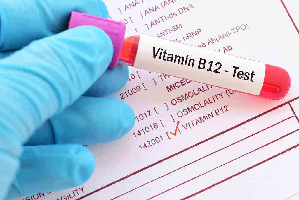 Kekurangan Vitamin B12: Gejala, Akibat, Cara Mengatasi