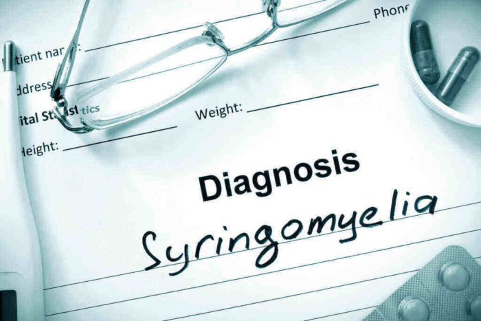 Syringomyelia: Gejala, Penyebab, Pengobatan, Dll - DokterSehat