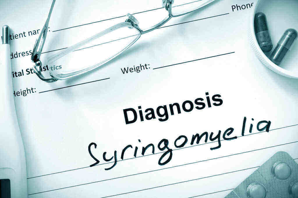 Syringomyelia: Gejala, Penyebab, Pengobatan, dll