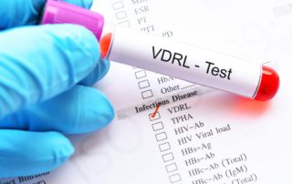 Tes VDRL: Manfaat, Prosedur, Hasil Tes, dan Komplikasi