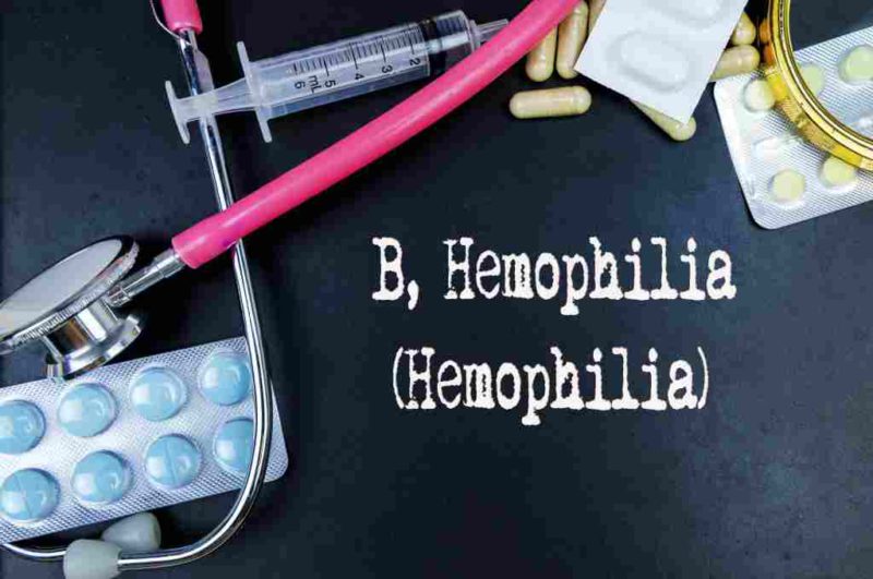 Hemofilia B: Gejala, Penyebab, Pengobatan, Dll - DokterSehat