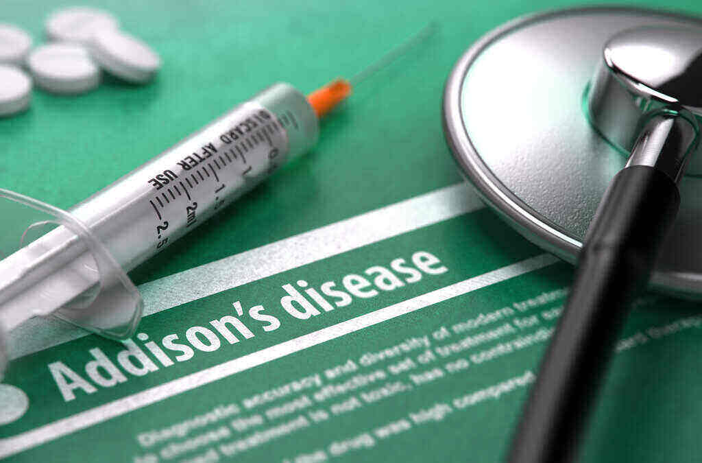 Penyakit Addison: Gejala, Penyebab, Pengobatan, dll