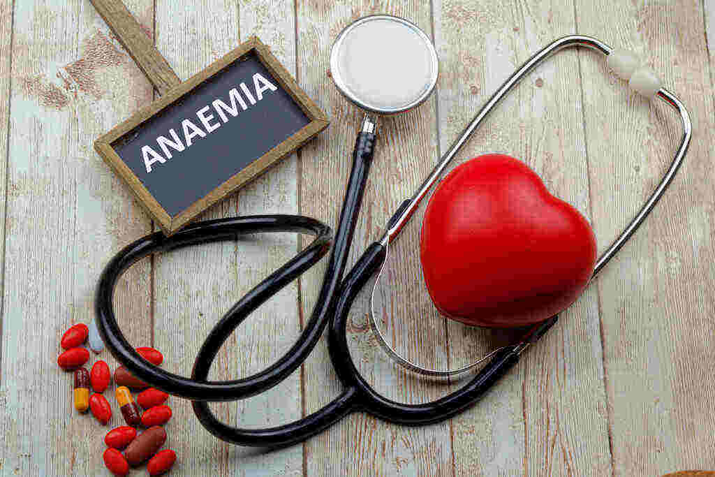 11 Cara Mencegah Anemia agar Tidak Mudah Lelah