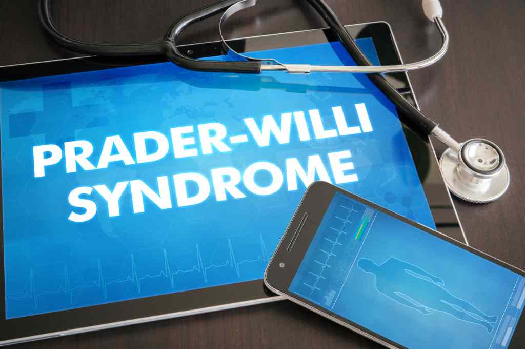 Sindrom Prader–Willi: Gejala, Penyebab, Pengobatan, dll