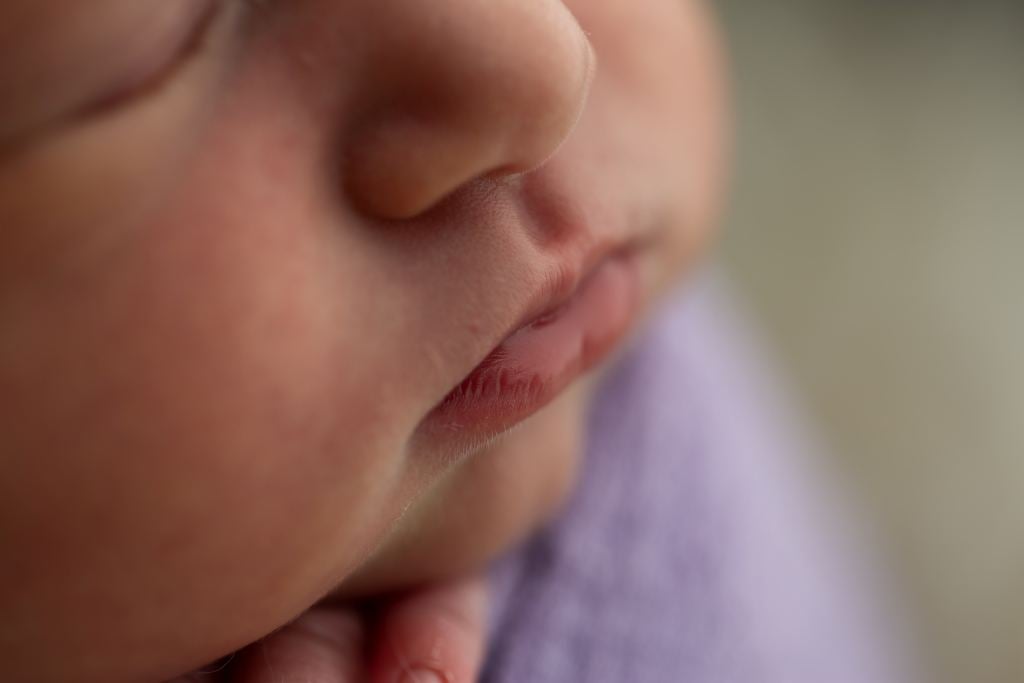 Bibir Kering pada Bayi: Penyebab dan Cara Mengatasinya