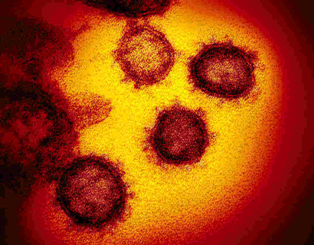 Mutasi Virus Corona D614G, Ini yang Perlu Diketahui