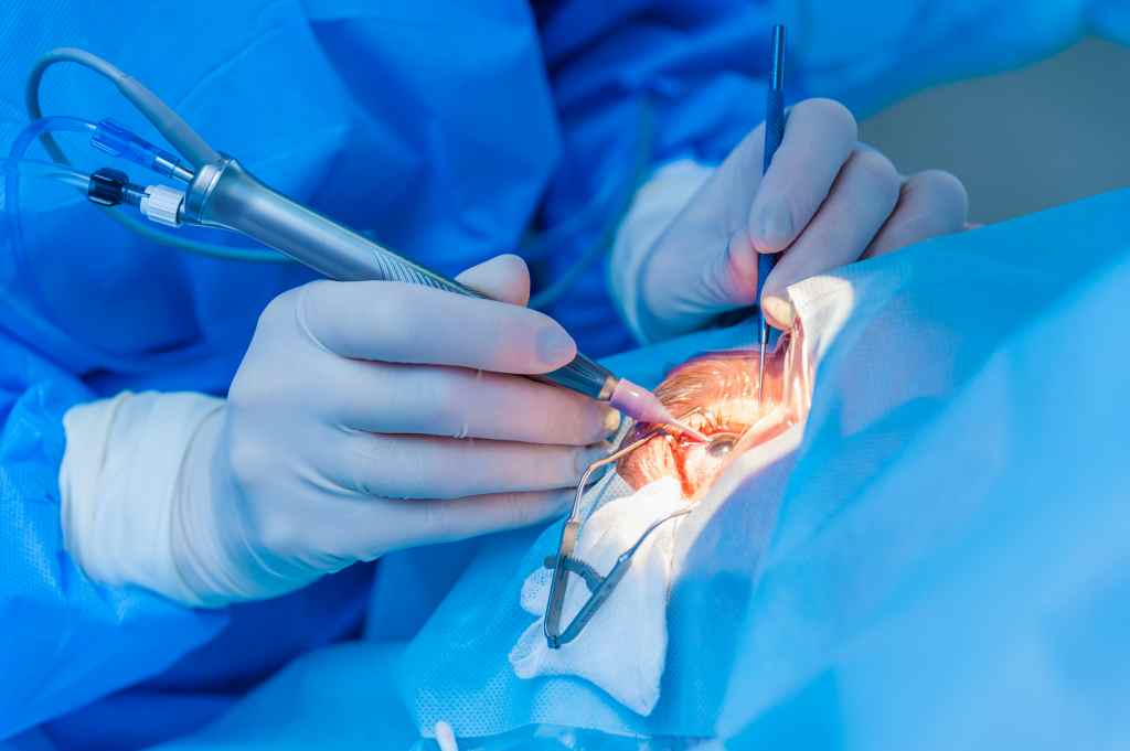 Transplantasi Kornea: Fungsi, Prosedur, Komplikasi, dll