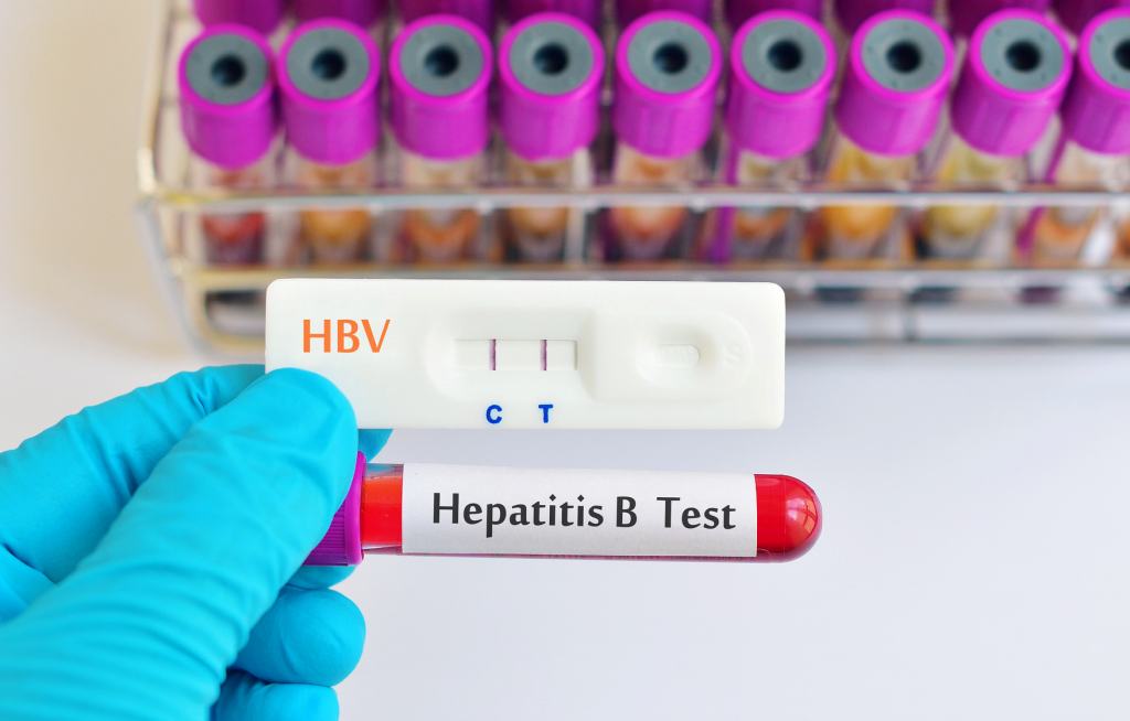 HBsAg, Tes untuk Memastikan Penyakit Hepatitis B