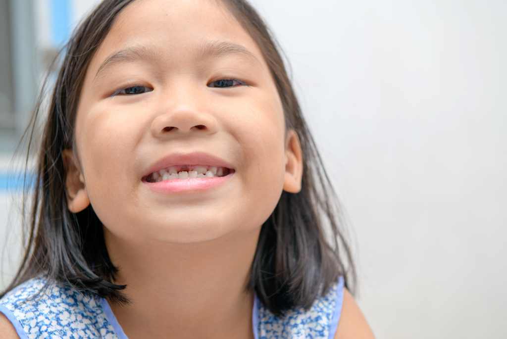 Berbagai Cara Mengatasi Gigi Ompong pada Anak, Orang Tua Harus Tahu