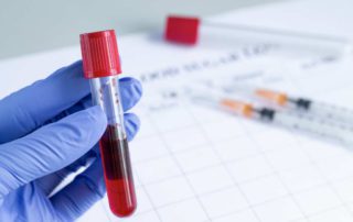 Hitung Darah Lengkap: Fungsi, Prosedur, dan Cara Membaca Hasilnya