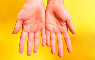Penyebab dan Cara Mengatasi Kulit Telapak Tangan Mengelupas