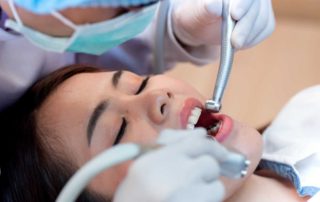 Ini Jenis Perawatan Gigi yang Ditanggung oleh BPJS Kesehatan