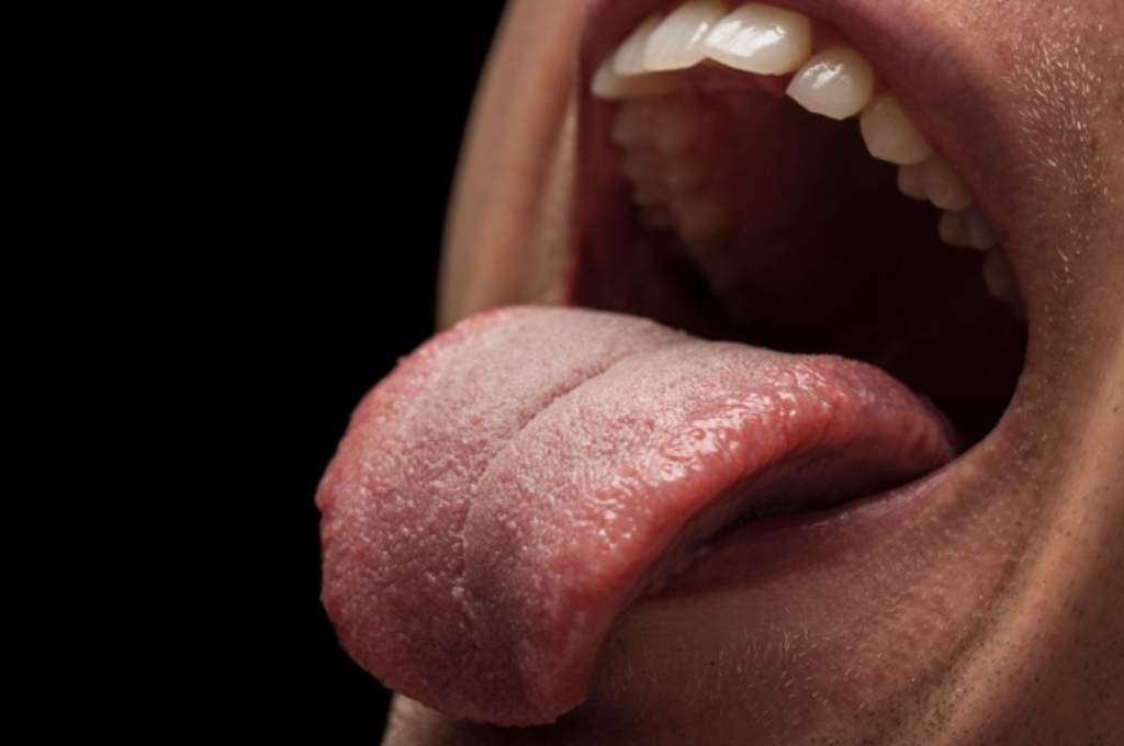 Tongue Thrust (Lidah Menjulur): Penyebab, Jenis, Cara Mengatasi