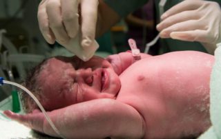 Vernix Caseosa, Lapisan Pelindung Bayi Baru Lahir yang Memiliki Banyak Manfaat