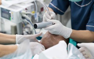 Intubasi Endotrakeal: Prosedur, Manfaat, dan Risikonya