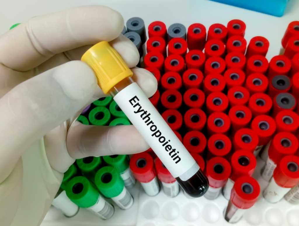 Mengenal Eritropoietin, Hormon yang Mengatur Produksi Sel Darah Merah