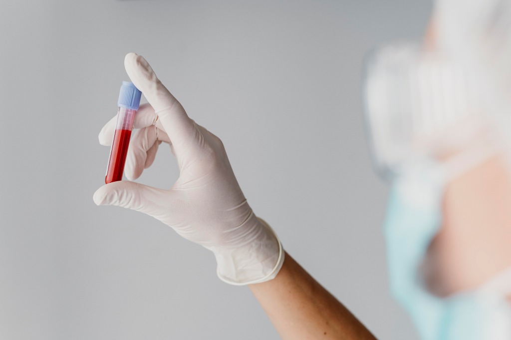 Pentingnya Pemeriksaan NS1 untuk Mendeteksi Deman Berdarah